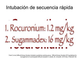 Intubación de secuencia rápida
Frerk C et al; Difficult Airway Society intubation guidelines working group.. Difficult Airway Society 2015 guidelines for
management of unanticipated difficult intubation in adults. Br J Anaesth. 2015 Dec;115(6):827-48.
 