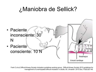 ¿Maniobra de Sellick?
• Paciente
inconsciente: 30
N
• Paciente
consciente: 10 N
Frerk C et al; Difficult Airway Society intubation guidelines working group.. Difficult Airway Society 2015 guidelines for
management of unanticipated difficult intubation in adults. Br J Anaesth. 2015 Dec;115(6):827-48.
 