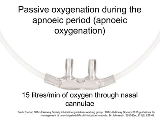 Passive oxygenation during the
apnoeic period (apnoeic
oxygenation)
15 litres/min of oxygen through nasal
cannulae
Frerk C et al; Difficult Airway Society intubation guidelines working group.. Difficult Airway Society 2015 guidelines for
management of unanticipated difficult intubation in adults. Br J Anaesth. 2015 Dec;115(6):827-48.
 