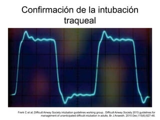 Confirmación de la intubación
traqueal
Frerk C et al; Difficult Airway Society intubation guidelines working group.. Difficult Airway Society 2015 guidelines for
management of unanticipated difficult intubation in adults. Br J Anaesth. 2015 Dec;115(6):827-48.
 