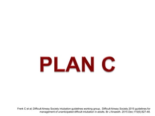Frerk C et al; Difficult Airway Society intubation guidelines working group.. Difficult Airway Society 2015 guidelines for
management of unanticipated difficult intubation in adults. Br J Anaesth. 2015 Dec;115(6):827-48.
 