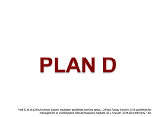 Frerk C et al; Difficult Airway Society intubation guidelines working group.. Difficult Airway Society 2015 guidelines for
management of unanticipated difficult intubation in adults. Br J Anaesth. 2015 Dec;115(6):827-48.
 