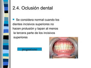 2.4. Oclusión dental
 Se considera normal cuando los
dientes incisivos superiores no
hacen protusión y tapan al menos
la tercera parte de los incisivos
superiores
prognatismo
 