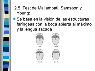 2.5. Test de Mallampati, Samsoon y
Young:
 Se basa en la visión de las estructuras
faríngeas con la boca abierta al máximo
y la lengua sacada
 