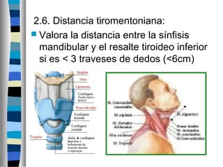 2.6. Distancia tiromentoniana:
 Valora la distancia entre la sínfisis
mandibular y el resalte tiroideo inferior
si es < 3 traveses de dedos (<6cm)
 