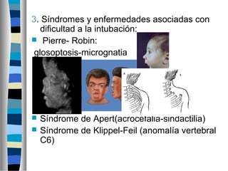 3. Síndromes y enfermedades asociadas con
dificultad a la intubación:
 Pierre- Robin:
glosoptosis-micrognatia
 Síndromes que se acompañen de
disminución o aumento de la distancia
intraocular
 Síndrome de Apert(acrocefalia-sindactilia)
 Síndrome de Klippel-Feil (anomalía vertebral
C6)
 