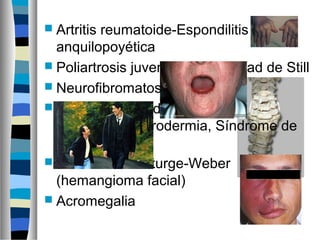  Artritis reumatoide-Espondilitis
anquilopoyética
 Poliartrosis juvenil o enfermedad de Still
 Neurofibromatosis
 Enfermedades del
colágeno:esclerodermia, Síndrome de
CREST
 Síndrome de Sturge-Weber
(hemangioma facial)
 Acromegalia
 