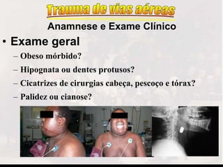 • Exame geral
– Obeso mórbido?
– Hipognata ou dentes protusos?
– Cicatrizes de cirurgias cabeça, pescoço e tórax?
– Palidez ou cianose?
Anamnese e Exame Clínico
 