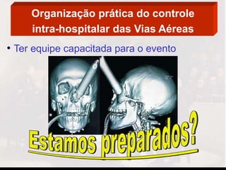 Organização prática do controle
intra-hospitalar das Vias Aéreas
• Ter equipe capacitada para o evento
 