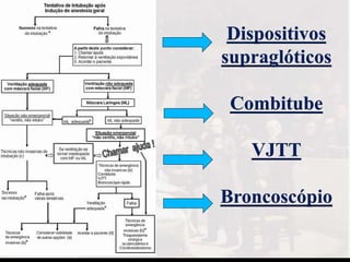 Dispositivos
supraglóticos
Combitube
VJTT
Broncoscópio
 