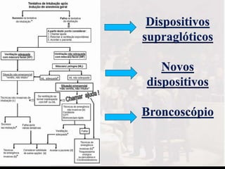 Dispositivos
supraglóticos
Novos
dispositivos
Broncoscópio
 