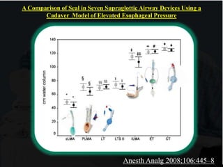 A Comparison of Seal in Seven Supraglottic Airway Devices Using a
Cadaver Model of Elevated Esophageal Pressure
Anesth Analg 2008;106:445–8
 