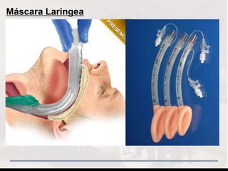 Máscara Laringea
 