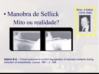 • Manobra de Sellick
Mito ou realidade?
Brian A Sellick
(1918-1996)
Sellick B.A. - Cricoid pressure to control regurgitation of stomach contents during
induction of anaesthesia. Lancet, 1961 ; 2 : 404.
 