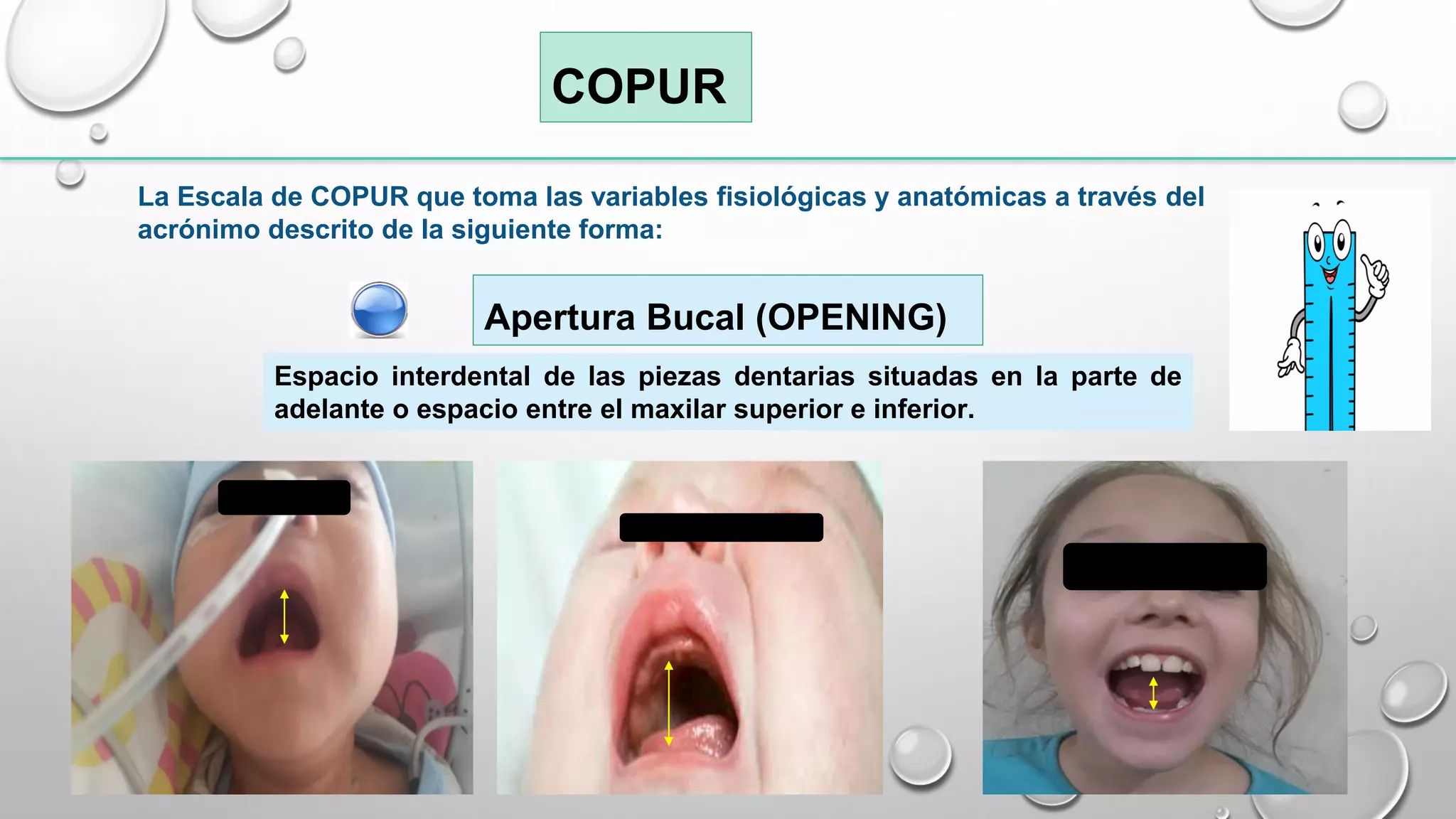 ESCALA DE COPUR VIA AEREA DIFICIL PEDIATRICA | PDF