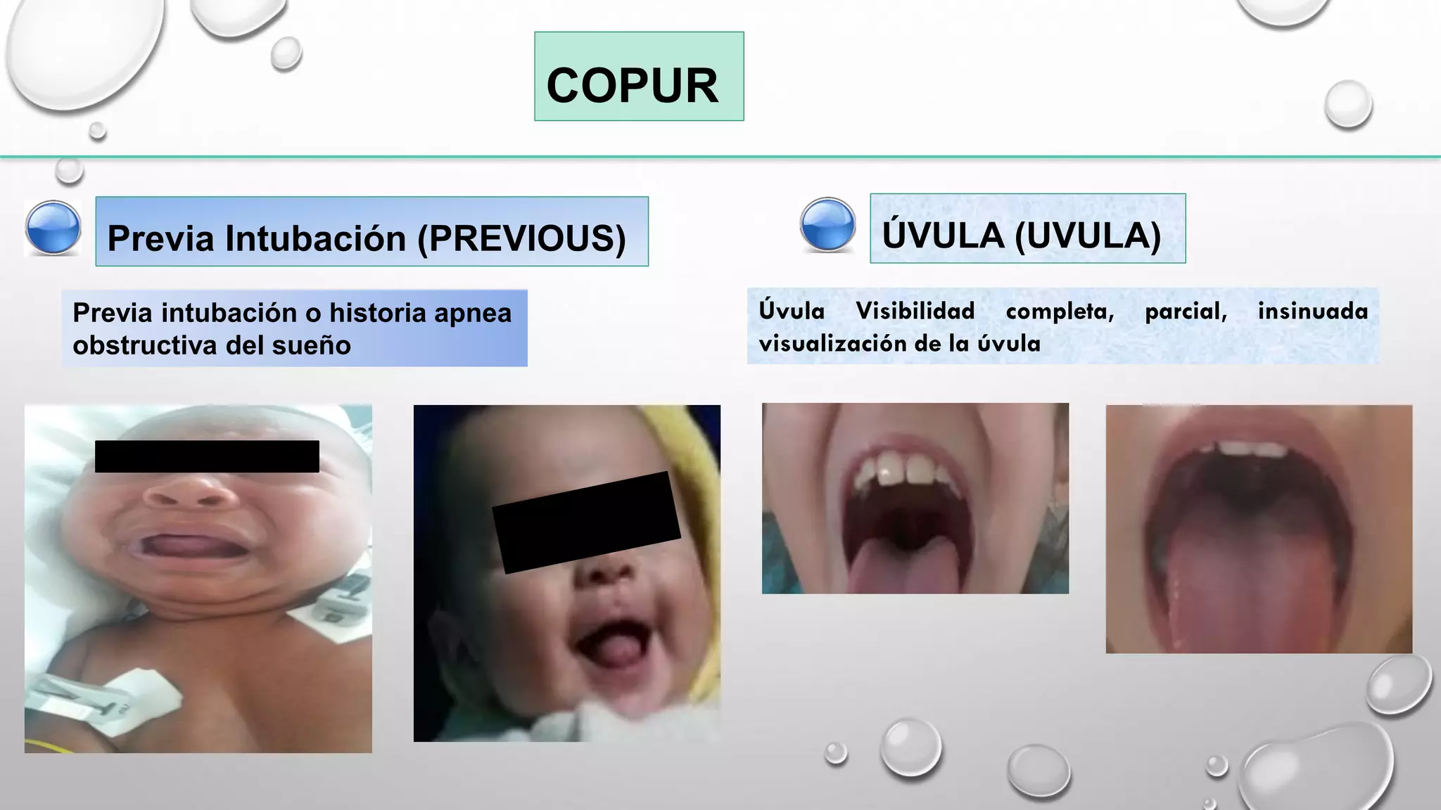 ESCALA DE COPUR VIA AEREA DIFICIL PEDIATRICA | PDF