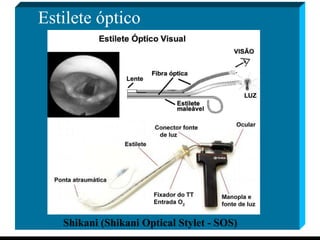 Estilete óptico Shikani (Shikani Optical Stylet - SOS) 