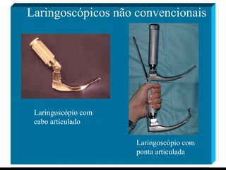 Laringoscópicos não convencionais Laringoscópio com  cabo articulado Laringoscópio com  ponta articulada 