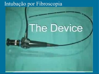 Intubação por Fibroscopia 