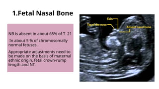 Viability and NT scan.pptx for ksoga in 2022 | PPTX