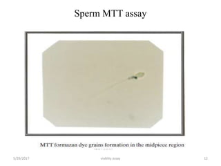 Sperm MTT assay
5/29/2017 viablity assay 12
 
