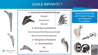 11
QUALE IMPIANTO ?
11
Classificazione della
Joint Implant Surgery
and Research
Foundation
 