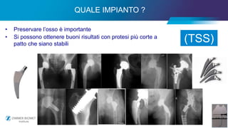 14
• Preservare l’osso è importante
• Si possono ottenere buoni risultati con protesi più corte a
patto che siano stabili
QUALE IMPIANTO ?
(TSS)
 