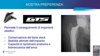 15
NOSTRA PREFERENZA:
Permette il conseguimento di importanti
obiettivi:
- Conservazione del bone stock
- Stabilità ottimale dell’impianto
- Capacità di ripristinare anatomia e
biomeccanica dell’anca
 