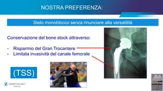16
Stelo monoblocco senza rinunciare alla versatilità
Conservazione del bone stock attraverso:
- Risparmio del Gran Trocantere
- Limitata invasività del canale femorale
NOSTRA PREFERENZA:
(TSS)
 