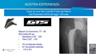 17
NOSTRA ESPERIENZA:
Casa di cura San Camillo Forte dei Marmi
Dal Dicembre 2010 ad oggi: 125 casi
Maschi Vs Femmine: 77 - 48
Età media 64 aa
- Standard (133°) 85
- Vara (122°) 40
- 74 via laterale diretta
- 47 via postero-laterale
- 4 A.L.D.I.
 