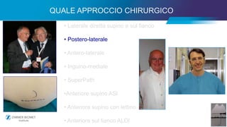 23
• Laterale diretta supino e sul fianco
• Postero-laterale
• Antero-laterale
• Inguino-mediale
• SuperPath
•Anteriore supino ASI
• Anteriore supino con lettino
• Anteriore sul fianco ALDI
QUALE APPROCCIO CHIRURGICO
 