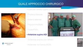 26
• Laterale diretta supino e sul fianco
• Postero-laterale
• Antero-laterale
• Inguino-mediale
• SuperPath
• Anteriore supino ASI
• Anteriore supino con lettino
• Anteriore sul fianco ALDI
QUALE APPROCCIO CHIRURGICO
 