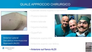 29
• Laterale diretta supino e sul fianco
• Postero-laterale
• Antero-laterale
• Inguino-mediale
• SuperPath
• Anteriore supino ASI
• Anteriore supino con lettino
• Anteriore sul fianco ALDI
QUALE APPROCCIO CHIRURGICO
 