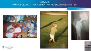 38
GIOVANI:
AMPIA SCELTA….. non CEMENTATI RICERCA MASSIMA TSS
 
