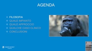  FILOSOFIA
 QUALE IMPIANTO
 QUALE APPROCCIO
 QUALCHE CASO CLINICO
 CONCLUSIONI
AGENDA
 