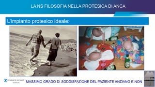7
LA NS FILOSOFIA NELLA PROTESICA DI ANCA
L’impianto protesico ideale:
MASSIMO GRADO DI SODDISFAZIONE DEL PAZIENTE ANZIANO E NON
 