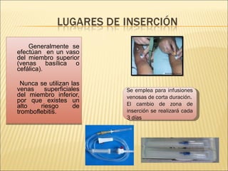 Generalmente se
efectúan en un vaso
del miembro superior
(venas basílica o
cefálica).
Nunca se utilizan las
venas superficiales
del miembro inferior,
por que existes un
alto riesgo de
tromboflebitis.
Se emplea para infusiones
venosas de corta duración.
El cambio de zona de
inserción se realizará cada
3 días
 