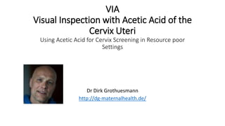 VIA
Visual Inspection with Acetic Acid of the
Cervix Uteri
Using Acetic Acid for Cervix Screening in Resource poor
Settings
Dr Dirk Grothuesmann
http://dg-maternalhealth.de/
 