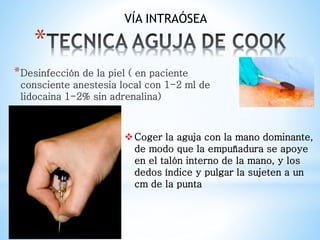 *
*Desinfección de la piel ( en paciente
consciente anestesia local con 1-2 ml de
lidocaina 1-2% sin adrenalina)
Coger la aguja con la mano dominante,
de modo que la empuñadura se apoye
en el talón interno de la mano, y los
dedos índice y pulgar la sujeten a un
cm de la punta
VÍA INTRAÓSEA
 