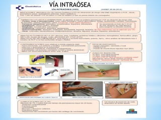 VÍA INTRAÓSEA
 