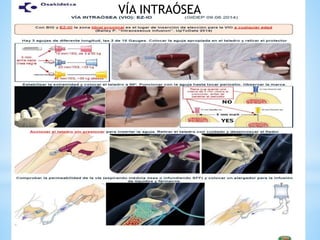 VÍA INTRAÓSEA
 