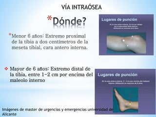 *
*Menor 6 años: Extremo proximal
de la tibia a dos centímetros de la
meseta tibial, cara antero interna.
VÍA INTRAÓSEA
 Mayor de 6 años: Extremo distal de
la tibia, entre 1-2 cm por encima del
maleolo interno
Imágenes de master de urgencias y emergencias universidad de
Alicante
 