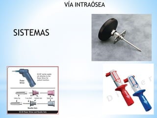 VÍA INTRAÓSEA
SISTEMAS
 