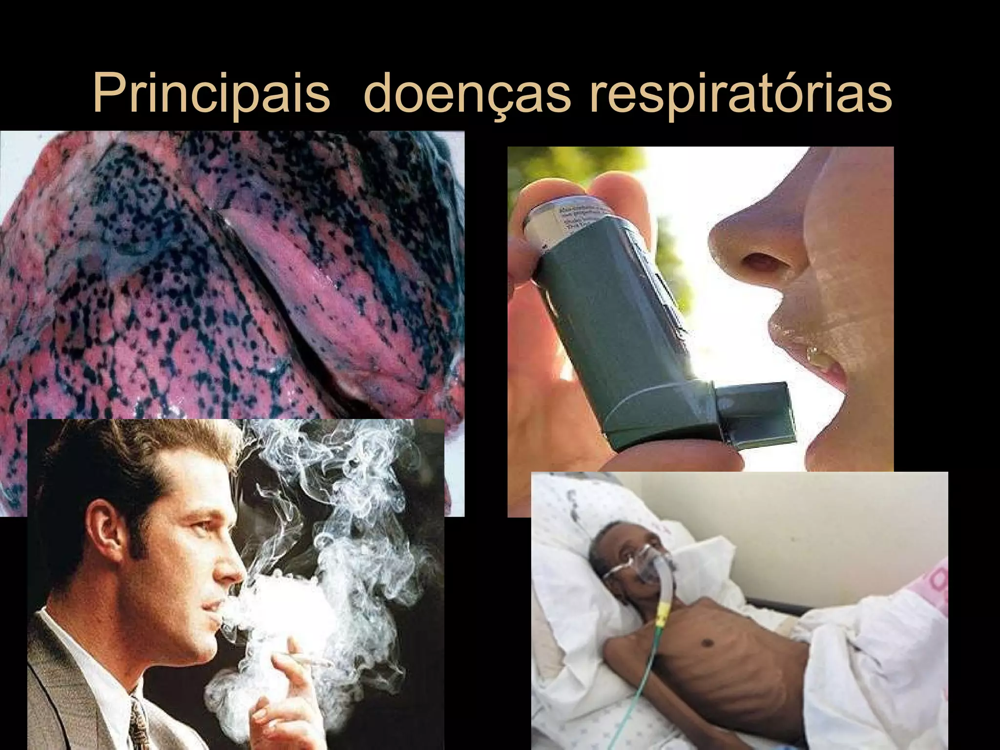 Principais  doenças respiratórias  
