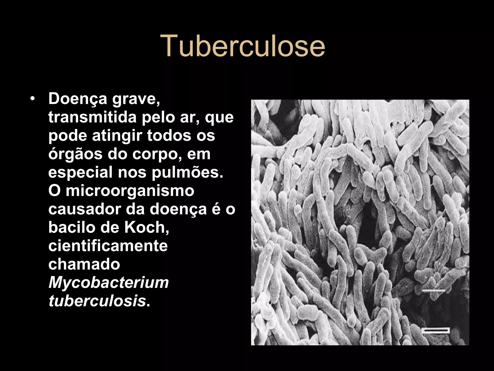 Tuberculose  Doença grave, transmitida pelo ar, que pode atingir todos os órgãos do corpo, em especial nos pulmões. O microorganismo causador da doença é o bacilo de Koch, cientificamente chamado  Mycobacterium tuberculosis .   