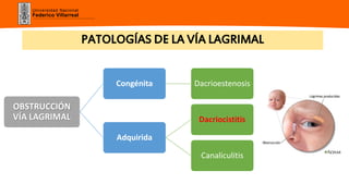 Universidad Nacional
Federico Villarreal
PATOLOGÍAS DE LA VÍA LAGRIMAL
OBSTRUCCIÓN
VÍA LAGRIMAL
Congénita Dacrioestenosis
Adquirida
Dacriocistitis
Canaliculitis
 