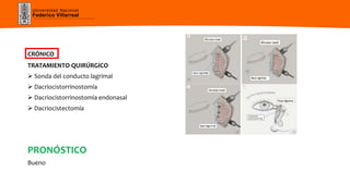 Universidad Nacional
Federico Villarreal
CRÓNICO
TRATAMIENTO QUIRÚRGICO
 Sonda del conducto lagrimal
 Dacriocistorrinostomía
 Dacriocistorrinostomía endonasal
 Dacriocistectomía
PRONÓSTICO
Bueno
 