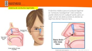 Universidad Nacional
Federico Villarreal
Sistema de conductos lagrimales
El término médico para el conducto lagrimal
es "conducto nasolagrimal". Este conducto
puede obstruirse en cualquier parte, pero un
lugar común de obstrucciones es donde las
lágrimas drenan hacia la nariz.
Anatomía del sistema lagrimal © 2022 UpToDate - Gráfico 90651 Versión 2.0
 