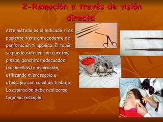 2-Remoción a través de visión directa   este método es el indicado si es  paciente tiene antecedente de  perforación timpánica. El tapón  se puede extraer con curetas,  pinzas, ganchitos adecuados  (cucharillas) o aspiración,  utilizando microscopio u  otoscopio con canal de trabajo.  La aspiración debe realizarse  bajo microscopio. 