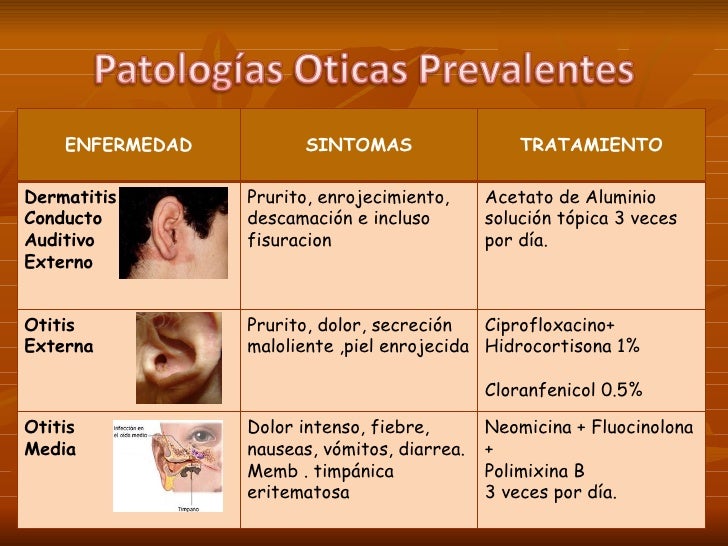 Paxlovid prescription or over the counter